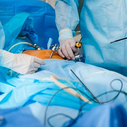 Паховая грыжа: Симптомы и методы лечения