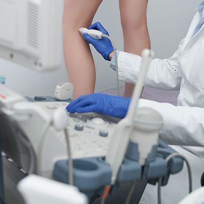 Варикозное расширение вен: как распознать и лечить