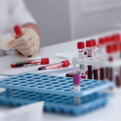 Повышенные печеночные пробы: причины и расшифровка анализов