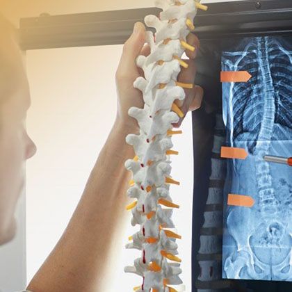 Какими видами спорта можно заниматься при межпозвонковой грыже?