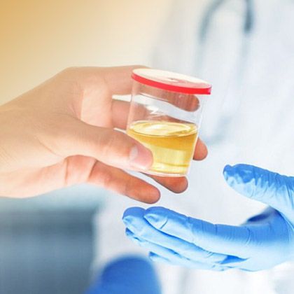 Анализ мочи ребенка: этапы сдачи и способы расшифровки