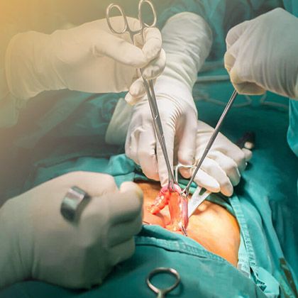 Аппендэктомия - удаление аппендицита