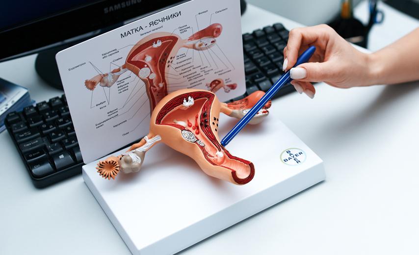 Лечение бартолинита в Киеве