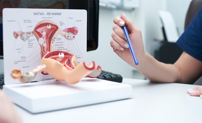 Лечение папилломавируса в Киеве