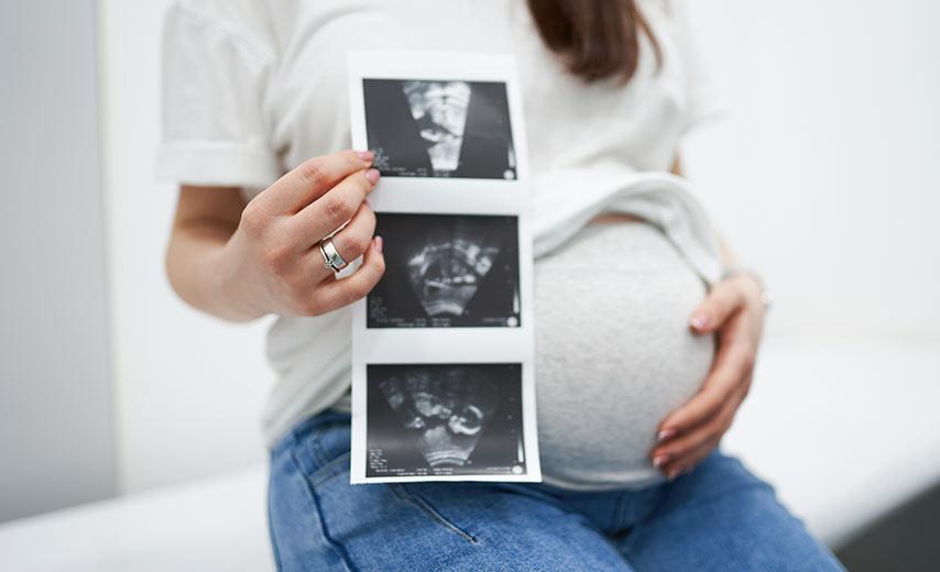 УЗИ при беременности в Киеве