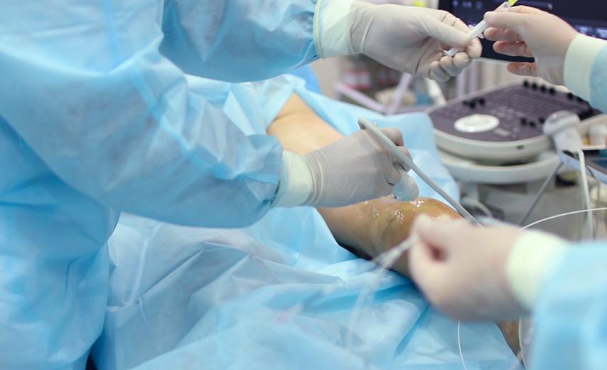 Удаление вен лазером в Киеве