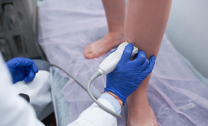 Лечение флебита в Киеве