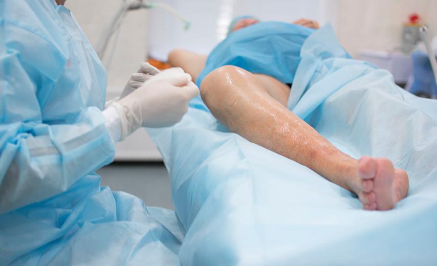 Удаление вен лазером в Киеве