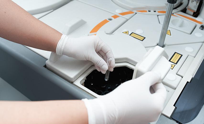 Общий анализ крови в Киеве