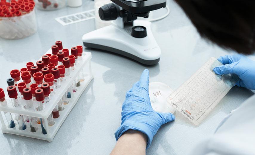 Бактериологический метод в Киеве