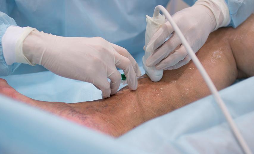 Микросклеротерапия в Киеве