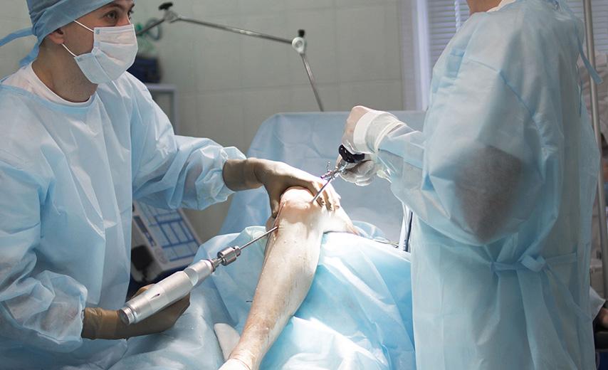 Лечение ложного сустава (псевдоартроза) в Киеве